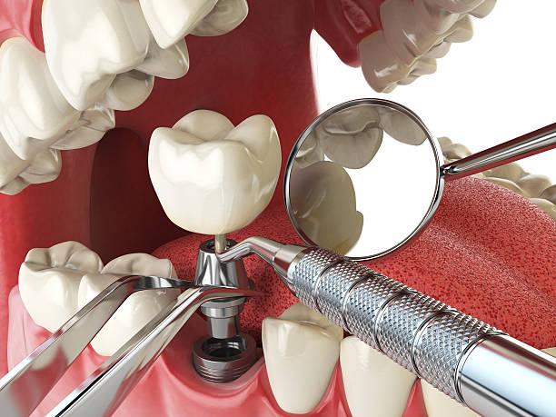 Best 24-Hour Emergency Dental Care in St Clair, MI